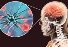 OMS: La pérdida de confianza en las vacunas aumentará los casos de neumonía y meningitis