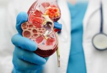 La enfermedad renal crónica es la novena causa principal de muerte en el mundo