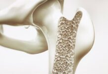 Un estudio identifica proteínas no colágenas implicadas en la remodelación de los huesos