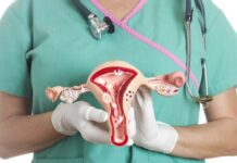 Cáncer de cuello uterino y HPV un cáncer que podemos prevenir
