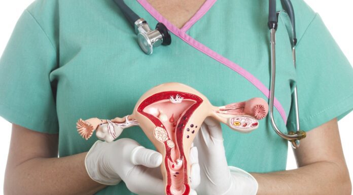 Cáncer de cuello uterino y HPV un cáncer que podemos prevenir