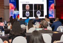 Especialista: La neurosonología detecta alteraciones cerebrales y tomar decisiones inmediatas ante un ACV