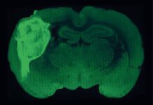 Cultivan tejido cerebral humano en modelos de ratón para el futuro estudio de enfermedades
